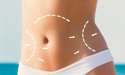 Abdomen and Sides
